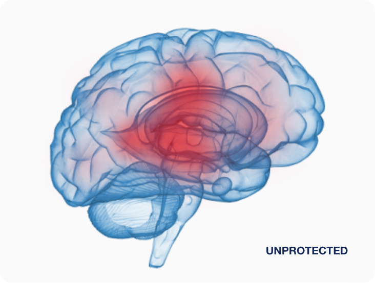 unprotected-brain